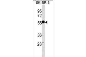 EEPD1 Antibody (C-term) (ABIN1537333 and ABIN2849670) western blot analysis in SK-BR-3 cell line lysates (35 μg/lane). (EEPD1 Antikörper  (C-Term))