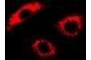 Immunofluorescent analysis of PDK4 staining in U2OS cells. (PDK4 Antikörper)