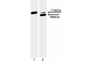 Western blot analysis of PARP cleavage.