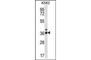 Western blot analysis of RPP38 Antibody (C-term) Cat. (RPP38 Antikörper  (C-Term))