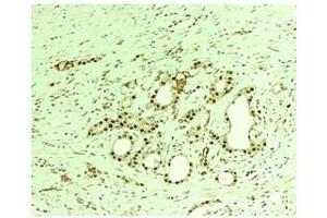 Immunohistochemistry (IHC) image for anti-THO Complex 1 (THOC1) (C-Term) antibody (ABIN2778931)