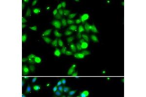 Immunofluorescence analysis of U2OS cells using UBE2G1 Polyclonal Antibody (UBE2G1 Antikörper)