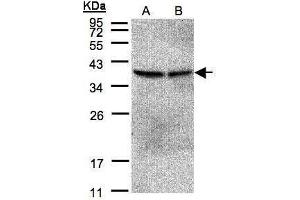 WB Image Sample(30 μg of whole cell lysate) A:293T B:A431, 12% SDS PAGE antibody diluted at 1:500 (PPP2CB Antikörper  (Center))