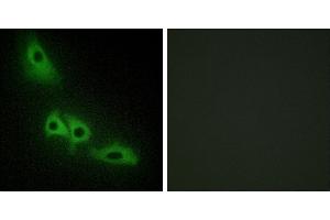 Peptide - +Western blot analysis of extracts from 293 cells and Jurkat cells, using GLPK antibody. (Glycerol Kinase Antikörper  (C-Term))