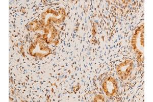 Immunohistochemistry (IHC) image for anti-Lamin A/C (LMNA) (pSer392) antibody (ABIN6256311)