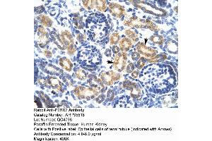 Immunohistochemistry (IHC) image for anti-Purinergic Receptor P2X, Ligand-Gated Ion Channel, 7 (P2RX7) (N-Term) antibody (ABIN2776335)