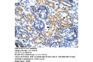 Human kidney (P2RX7 Antikörper  (N-Term))