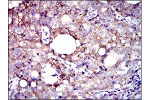 Immunohistochemistry (IHC) image for anti-Integrin beta 1 (ITGB1) antibody (ABIN1844058) (ITGB1 Antikörper)
