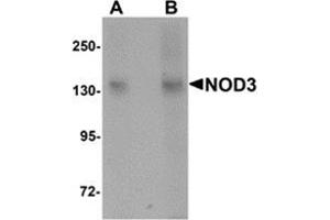 Western blot analysis of NOD3 in 3T3 cell lysate with NOD3 antibody at (A) 1 and (B) 2 μg/ml. (NLRC3 Antikörper  (Center))