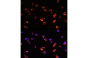 Immunofluorescence analysis of L929 cells using B antibody (ABIN6130859, ABIN6137109, ABIN6137110 and ABIN6220869) at dilution of 1:100. (ARL13B Antikörper  (AA 1-240))