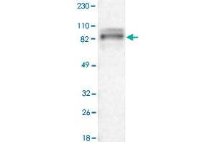 Western Blot analysis of RT-4 cell lysate with ARHGEF6 polyclonal antibody . (ARHGEF6 Antikörper)