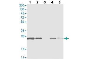 Western blot analysis of Lane 1: RT-4, Lane 2: U-251 MG, Lane 3: Human Plasma, Lane 4: Liver, Lane 5: Tonsil with C1orf52 polyclonal antibody  at 1:250-1:500 dilution. (C1ORF52 Antikörper)