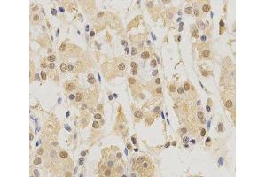 Immunohistochemistry (Paraffin-embedded Sections) (IHC (p)) image for anti-Proteasome (Prosome, Macropain) Subunit, beta Type, 5 (PSMB5) antibody (ABIN7260015)