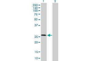 Western Blot analysis of KCNIP3 expression in transfected 293T cell line by KCNIP3 MaxPab polyclonal antibody. (DREAM Antikörper  (AA 1-256))