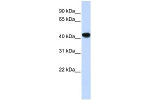 ADH1B antibody used at 1 ug/ml to detect target protein. (ADH1B Antikörper)