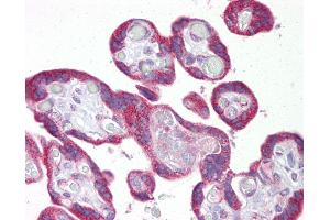 Anti-KRT23 / Cytokeratin 23 antibody IHC of human placenta. (KRT23 Antikörper  (C-Term))