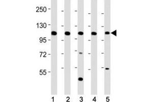Western blot testing of Mertk antibody at 1:2000 dilution.