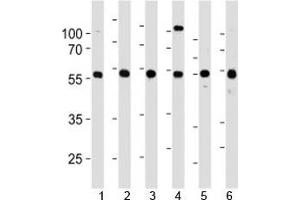 YY1 antibody western blot analysis in 1) 293, 2) HL-60, 3) SiHa, 4) K562, 5) THP-1 and 6) U266 lysate. (YY1 Antikörper  (AA 74-104))
