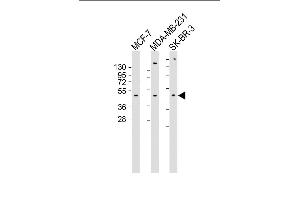 All lanes : Anti-ADRA2B Antibody (Center) at 1:1000 dilution Lane 1: MCF-7 whole cell lysate Lane 2: MDA-MB-231 whole cell lysate Lane 3: SK-BR-3 whole cell lysate Lysates/proteins at 20 μg per lane. (ADRA2B Antikörper  (AA 343-369))