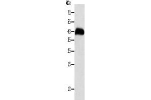 Gel: 10 % SDS-PAGE, Lysate: 40 μg, Lane: Human thigh malignant fibrous histiocytoma tissue, Primary antibody: ABIN7131272(SYT5 Antibody) at dilution 1/100, Secondary antibody: Goat anti rabbit IgG at 1/8000 dilution, Exposure time: 8 hours (Synaptotagmin V Antikörper)