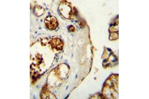 Immunohistochemical staining of formalin-fixed and paraffin-embedded human placenta tissue reacted with TNK1 monoclonal antibody  at 1:50-1:100 dilution.