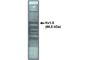 Western blot analysis using Kv1.