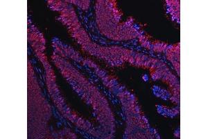 IF analysis of TIP49A/RUVBL1 using anti-TIP49A/RUVBL1 antibody (ABIN7599928). (RUVBL1 Antikörper  (AA 13-23))