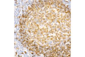 Immunohistochemistry of paraffin-embedded Human tonsil using CD79a antibody (ABIN7265805) at dilution of 1:100 (40x lens). (CD79a Antikörper)