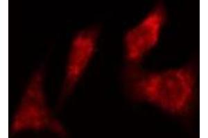 ABIN6277985 staining  Hela cells by IF/ICC. (CDC6 Antikörper)