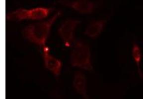 ABIN6275489 staining NIH-3T3 cells by IF/ICC. (ARHGAP11A Antikörper  (C-Term))