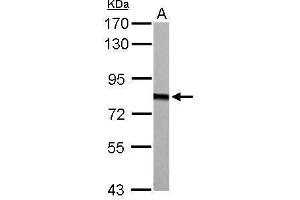 Western Blotting (WB) image for anti-Hydroxyacyl-Coenzyme A Dehydrogenase/3-Ketoacyl-Coenzyme A Thiolase/enoyl-Coenzyme A Hydratase (Trifunctional Protein), alpha Subunit (HADHA) (C-Term) antibody (ABIN2854961)