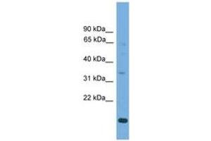 Image no. 1 for anti-Solute Carrier Family 25, Member 44 (SLC25A44) (C-Term) antibody (ABIN6745599)