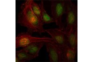 Immunofluorescence analysis of Hela cells using ZBTB7B antibody (green). (ZBTB7B Antikörper)