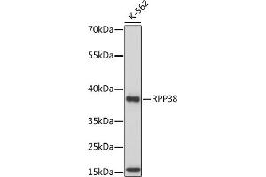 Western blot analysis of extracts of various cell lines, using RPP38 antibody (ABIN7269983) at 1:1000 dilution. (RPP38 Antikörper  (AA 20-110))