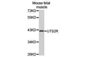 Western Blotting (WB) image for anti-Urotensin 2 Receptor (UTS2R) antibody (ABIN1875304)