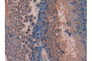 DAB staining on IHC-P; Samples: Mouse Testis Tissue (Pituitary Adenylate Cyclase Activating Peptide (AA 1-175) Antikörper)
