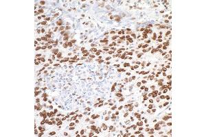 Immunohistochemistry (IHC) image for anti-Metastasis Associated 1 (MTA1) (C-Term) antibody (ABIN7454687)