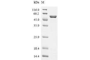 (Tris-Glycine gel) Discontinuous SDS-PAGE (reduced) with 5 % enrichment gel and 15 % separation gel.