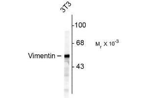 Image no. 1 for anti-Vimentin (VIM) antibody (ABIN372741) (Vimentin Antikörper)