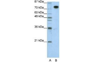 WB Suggested Anti-SFPQ Antibody Titration:  1. (SFPQ Antikörper  (N-Term))