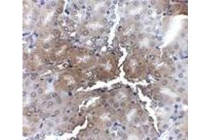 Immunohistochemistry of AP2M1 in mouse kidney tissue with AP2M1 antibody at 2.