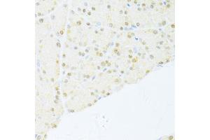 Immunohistochemistry of paraffin-embedded rat pancreas using NR1I2 antibody (ABIN5970763) at dilution of 1/100 (40x lens). (NR1I2 Antikörper)