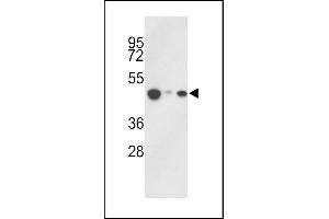 Western blot analysis of hHAT1- (ABIN387932 and ABIN2844437) in 293, HepG2, Jurkat cell line lysates (35 μg/lane).