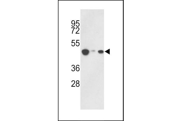HAT1 antibody  (C-Term)