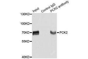 Immunoprecipitation analysis of extracts of HepG2 cells using PCK2 antibody. (PEPCK Antikörper  (AA 1-280))