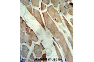 Formalin-fixed and paraffin-embedded human skeletal musclereacted with CKM polyclonal antibody , which was peroxidase-conjugated to the secondary antibody, followed by AEC staining.