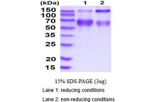 SDS-PAGE (SDS) image for Lysosomal-Associated Membrane Protein 2 (LAMP2) (AA 26-379) protein (His tag) (ABIN5854611) (LAMP2 Protein (AA 26-379) (His tag))