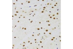 Immunohistochemistry of paraffin-embedded rat brain using CSRP3 Antibody (ABIN2562048) at dilution of 1:100 (40x lens). (CSRP3 Antikörper)