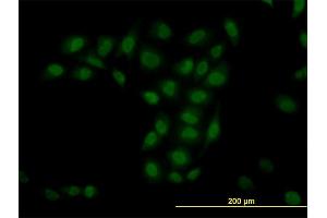 Immunofluorescence of monoclonal antibody to TRIM33 on HeLa cell. (TRIM33 Antikörper  (AA 1006-1105))