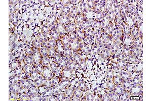 Immunohistochemistry (IHC) image for anti-Solute Carrier Family 2 (Facilitated Glucose Transporter), Member 4 (SLC2A4) (AA 401-509) antibody (ABIN739445)